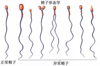 不良习惯会让精子无辜死亡