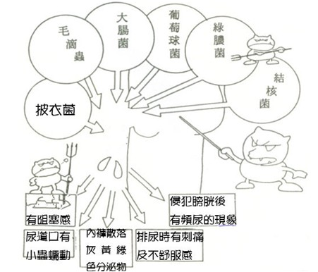 男性尿道流脓是怎么回事