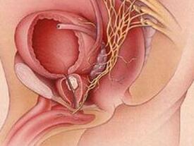 那么尿道口红肿是什么原因