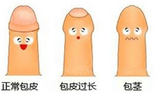 铜川做包皮手术哪家医院好?